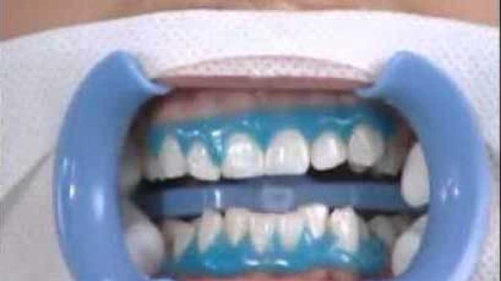  إليك 6 طرق طبيعية لتبييض الأسنان تغنيك عن المعجون